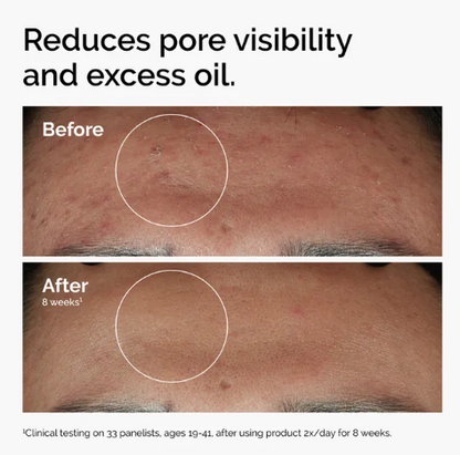 The Ordinary Niacinamide 10% + Zinc 1% 30ml